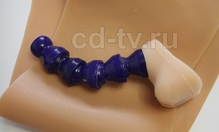 фаллопротез на член купить