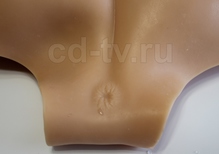 фаллопротез на член купить