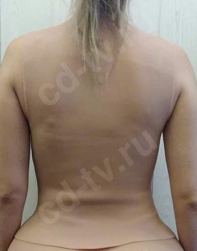 Купить женский торс с жидким силиконом